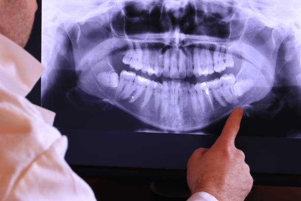 Best Broken or Cracked Tooth Emergency Dentist in Shadybrook, TX
